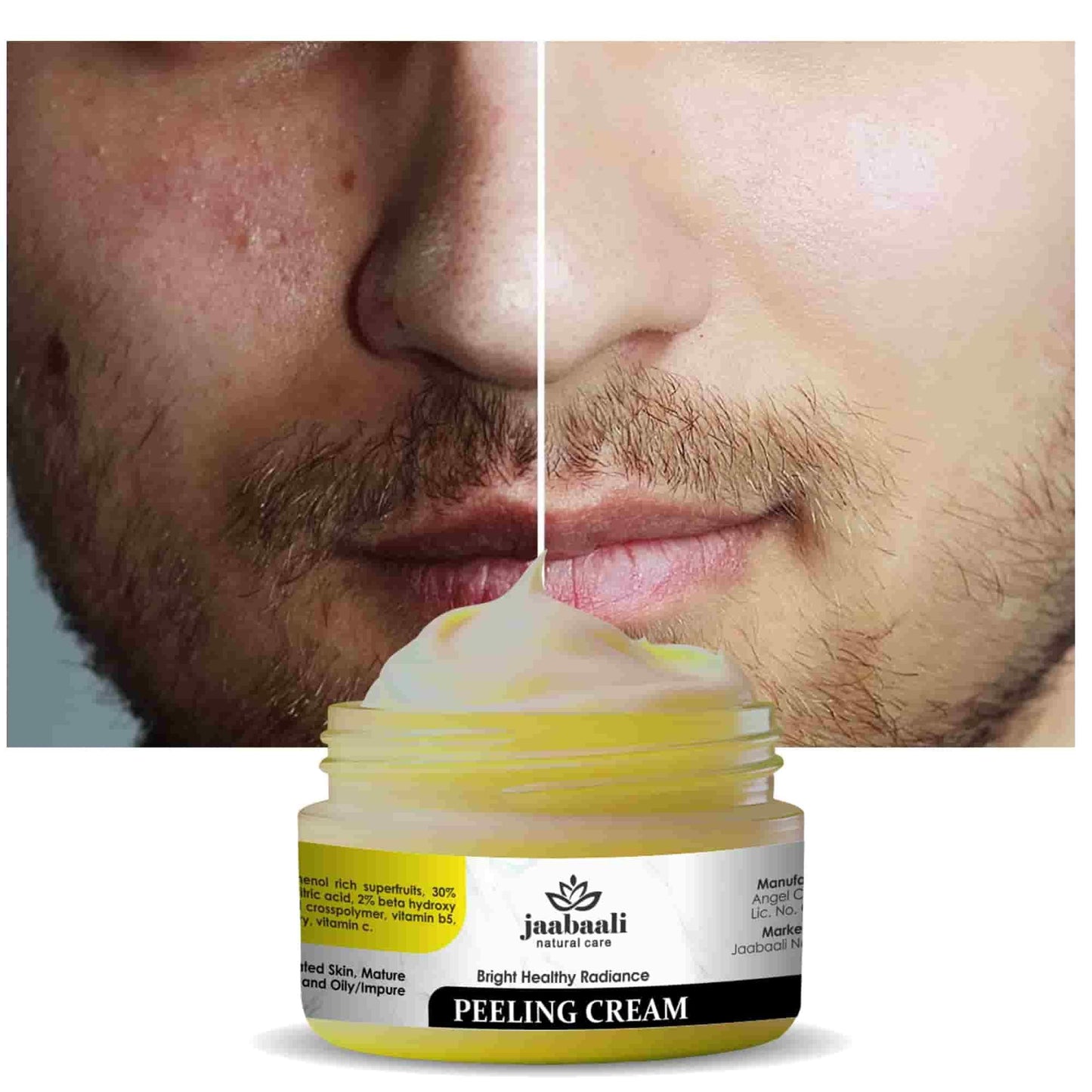 Bright Healthy Radiance Peeling Cream 90gm