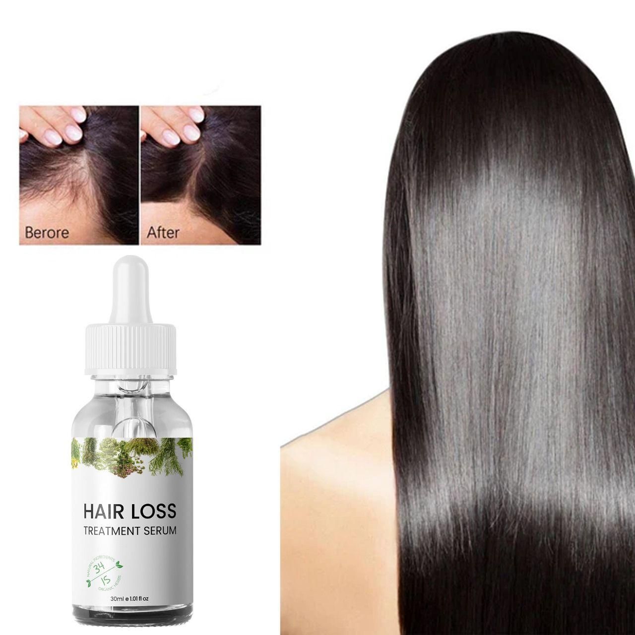 Hair Loss Treatment Serum 30Ml (Pack Of 2)